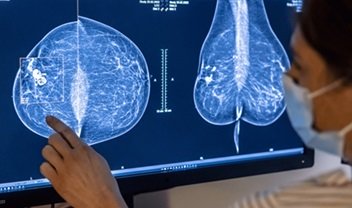 AsymMirai, AI Penolong Wanita yang Berisiko Dibenci "Dokter"