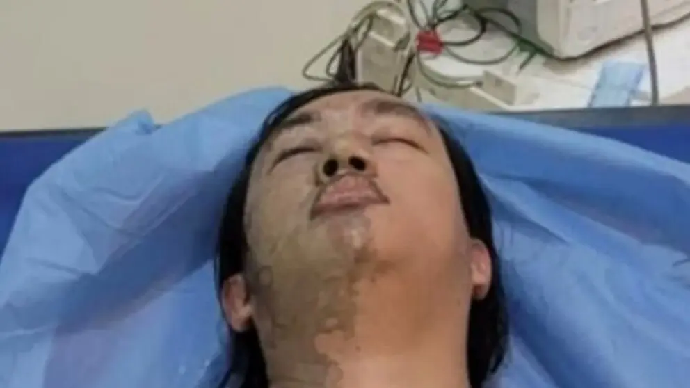 Presisi Maut dan Cairan Pengecut